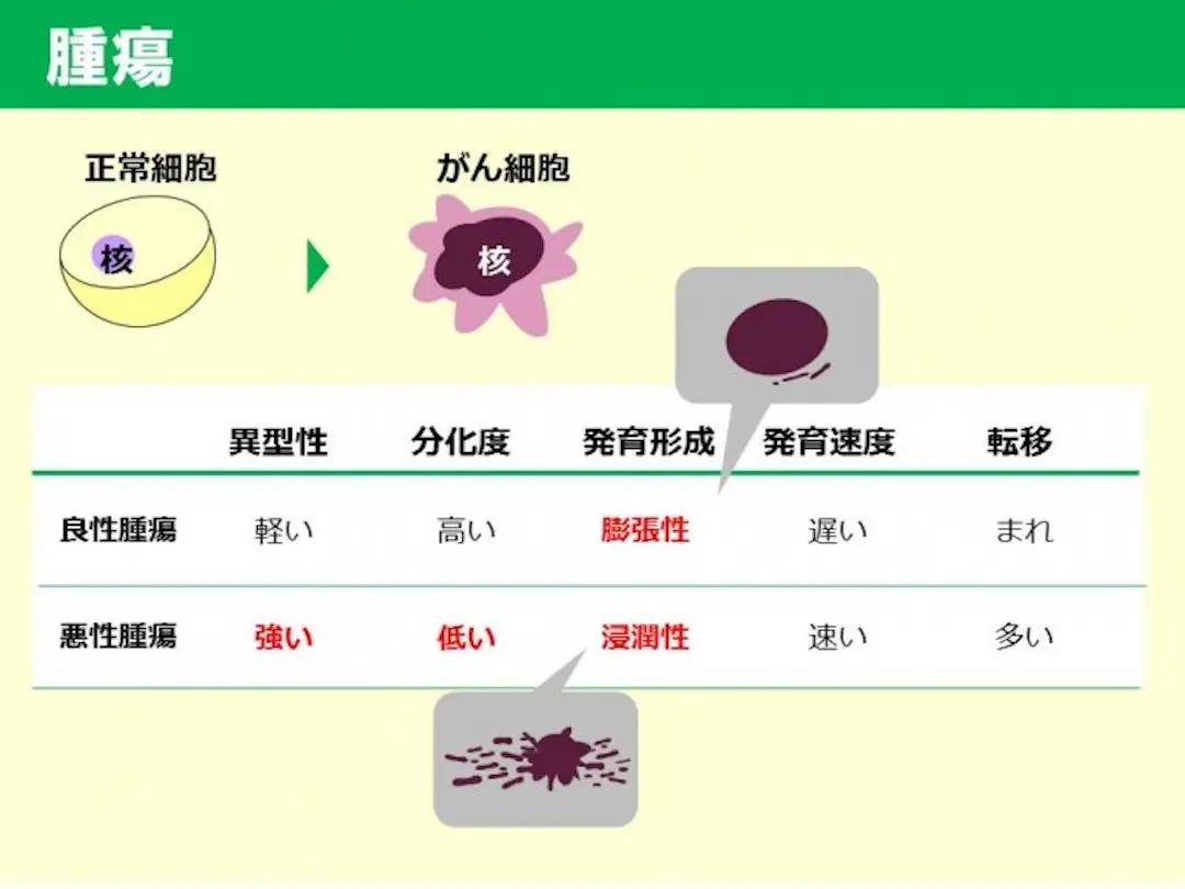 腫瘍の大きさと位置は治療にどのような影響を与えますか?