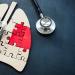 肺がんの再発リスクはどれくらい?再発した場合の症状や治療法も紹介