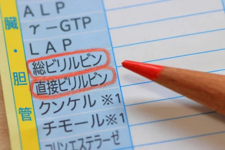 黄疸が出たら、余命はどれくらい？病気と黄疸の関係を解説