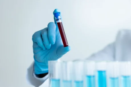 骨髄異形成症候群は治療しないとどうなる？経過や予後を解説